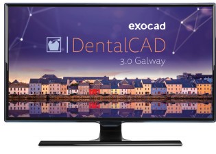 exocad dentalcad galway
